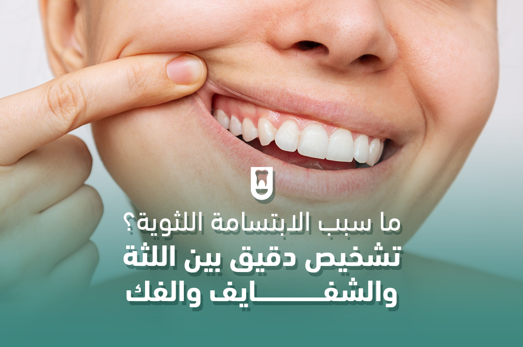 ما سبب الابتسامة اللثوية؟ تشخيص دقيق بين اللثة والشفايف والفك قبل اختيار العلاج المناسب
