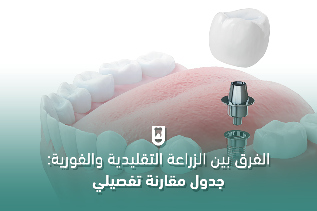 الفرق بين الزراعة التقليدية والفورية: جدول مقارنة تفصيلي لكل ما تحتاج معرفته