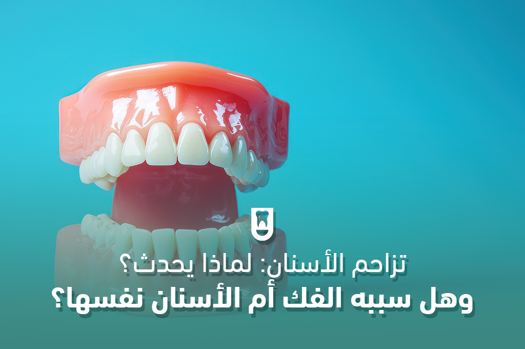 تزاحم الأسنان: لماذا يحدث؟ وهل سببه الفك أم الأسنان نفسها؟ تحليل طبي شامل