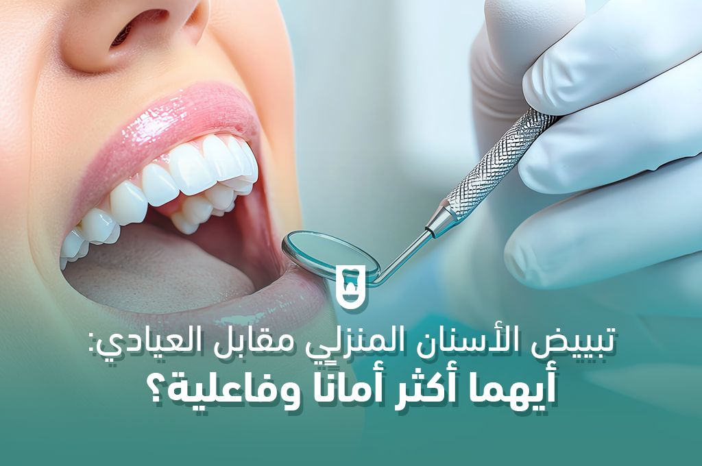 تبييض الأسنان المنزلي مقابل العيادي: أيهما أكثر أمانًا وفاعلية؟