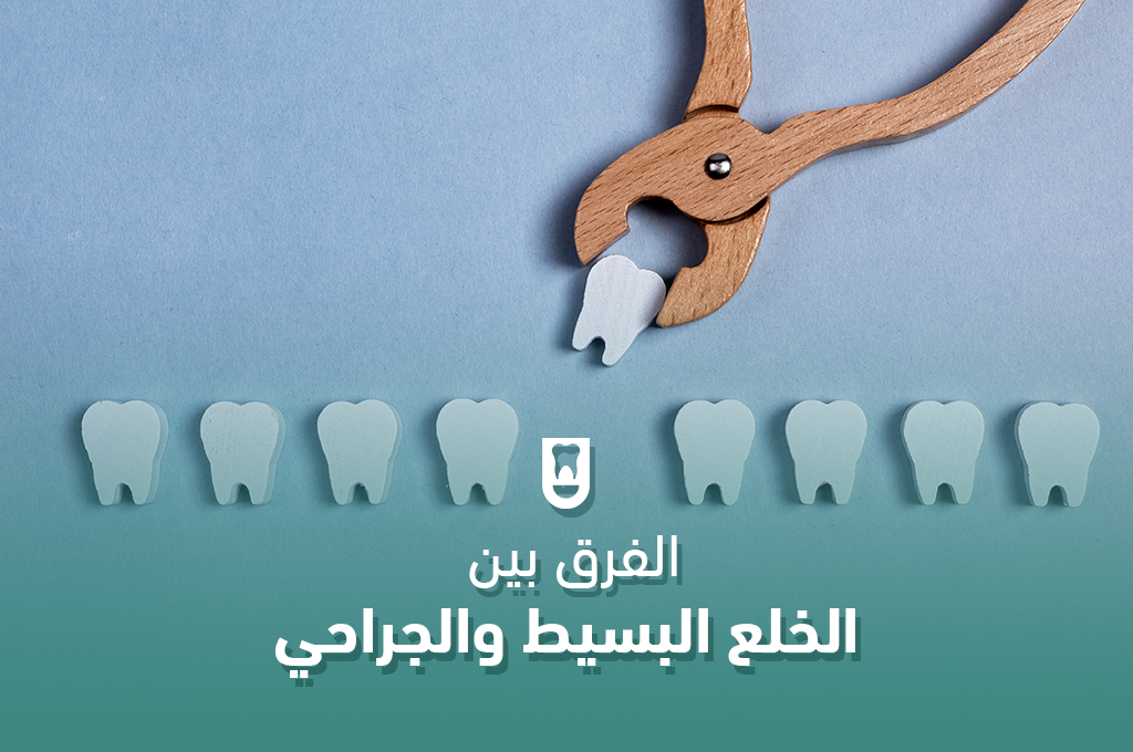 الفرق بين الخلع البسيط والجراحي: دليل شامل