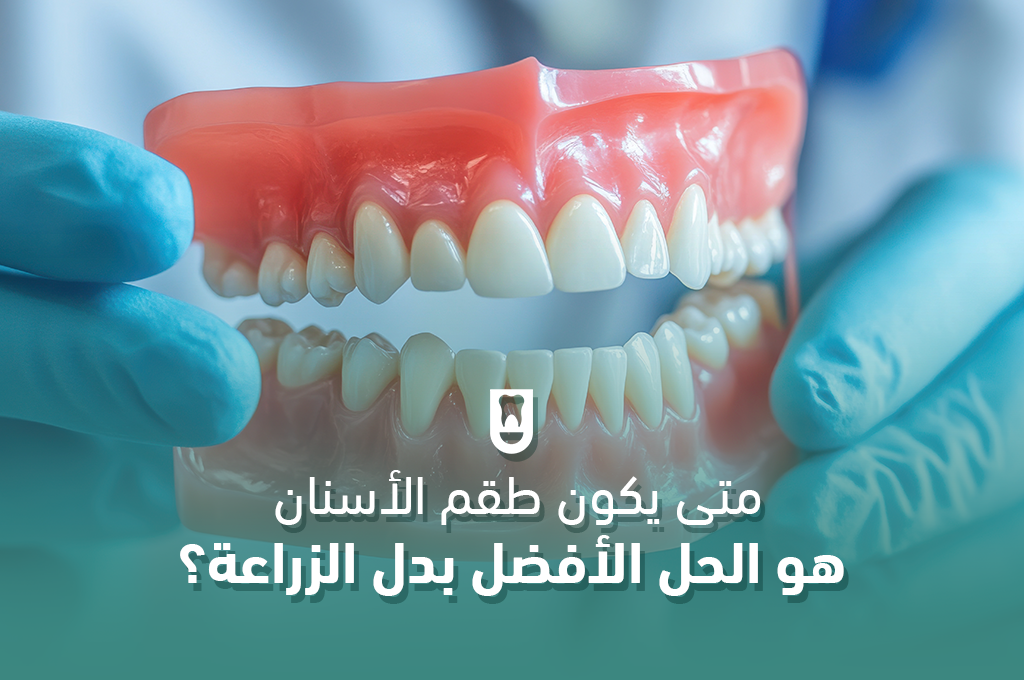 متى يكون طقم الأسنان هو الحل الأفضل بدل الزراعة؟