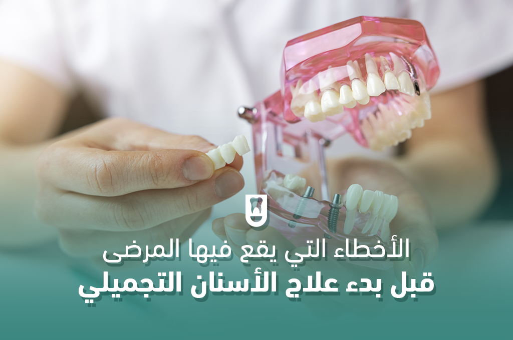 الأخطاء التي يقع فيها المرضى قبل بدء علاج الأسنان التجميلي