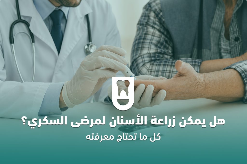 هل يمكن زراعة الأسنان لمرضى السكري؟ كل ما تحتاج معرفته