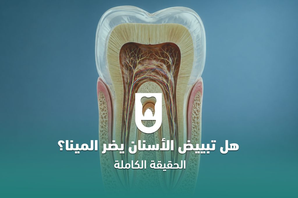 هل تبييض الأسنان يضر المينا؟ الحقيقة الكاملة