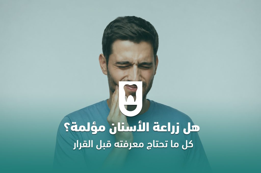 هل زراعة الأسنان مؤلمة؟ كل ما تحتاج معرفته قبل اتخاذ القرار