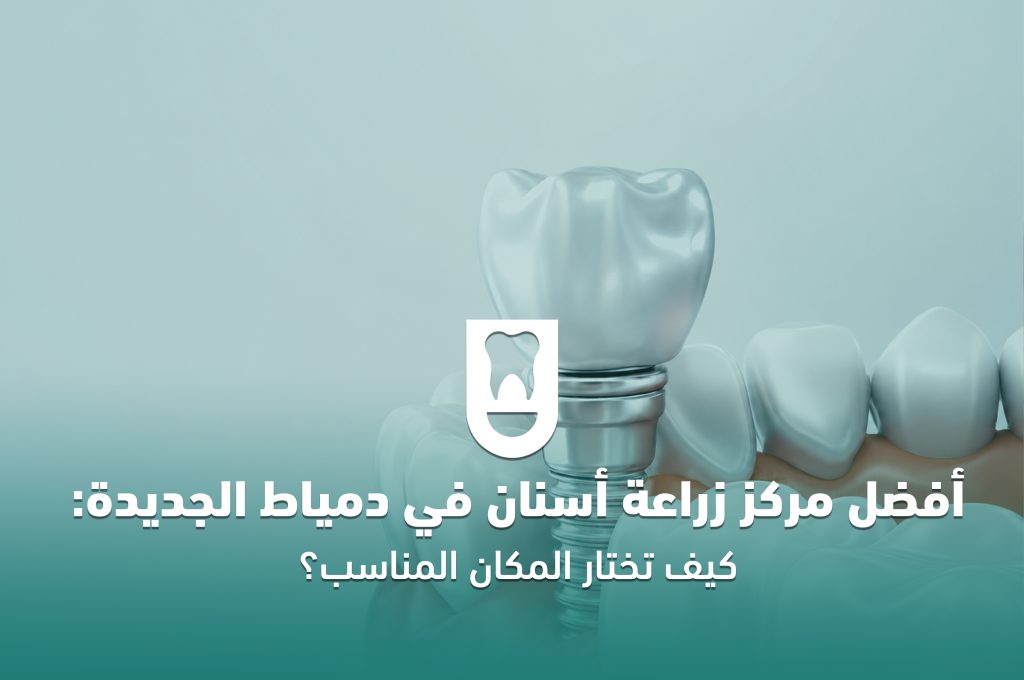 أفضل مركز زراعة أسنان في دمياط الجديدة: كيف تختار المكان المناسب؟