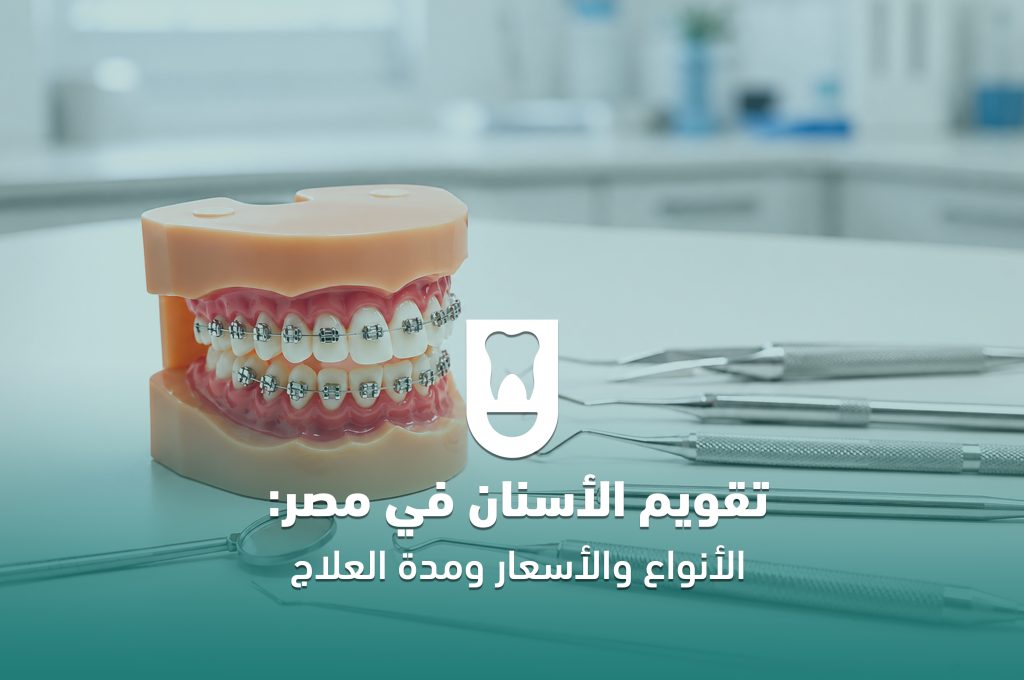 تقويم الأسنان في مصر: الأنواع والأسعار ومدة العلاج